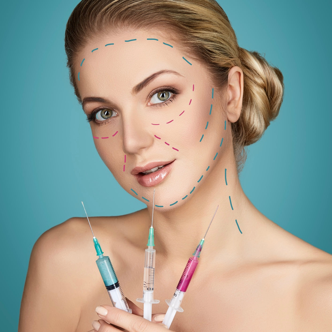 Anglian Aesthetics Dermal Filler Dissolve Hyaluronidase Treatment Mobile Service East Anglia 